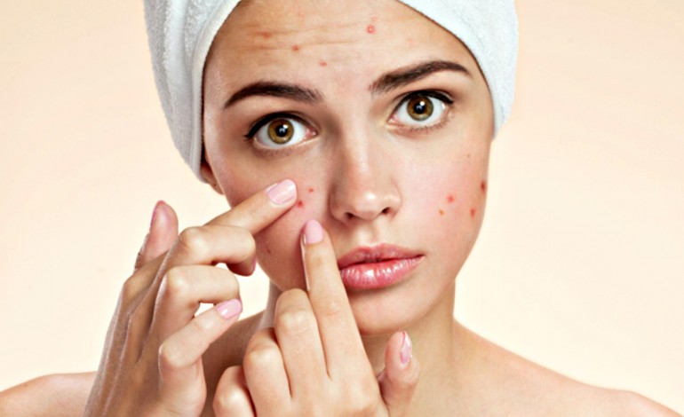 Rijden envelop bonen Wat te doen tegen acne (voeding) | La Chel